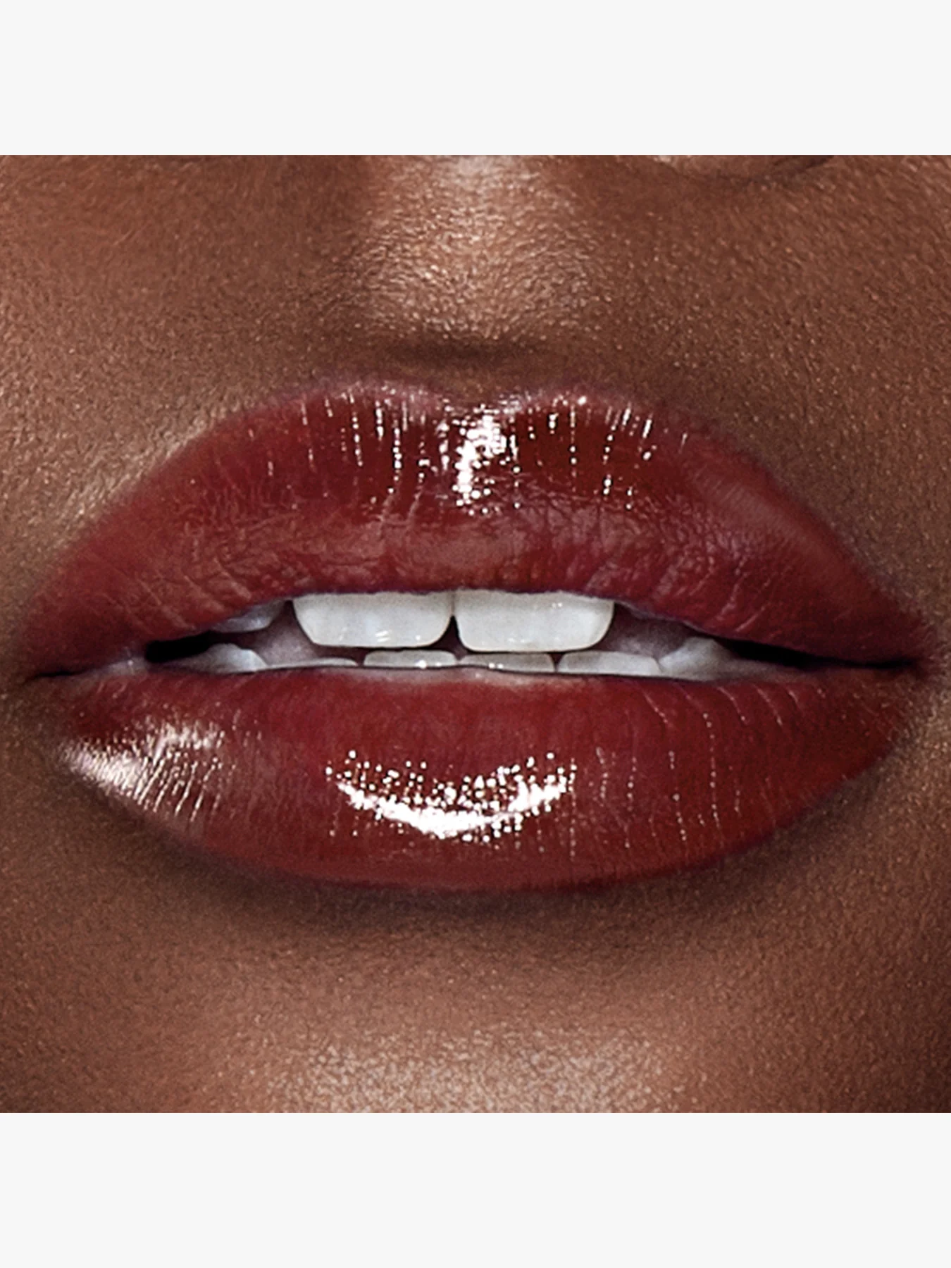 Superstar Lips