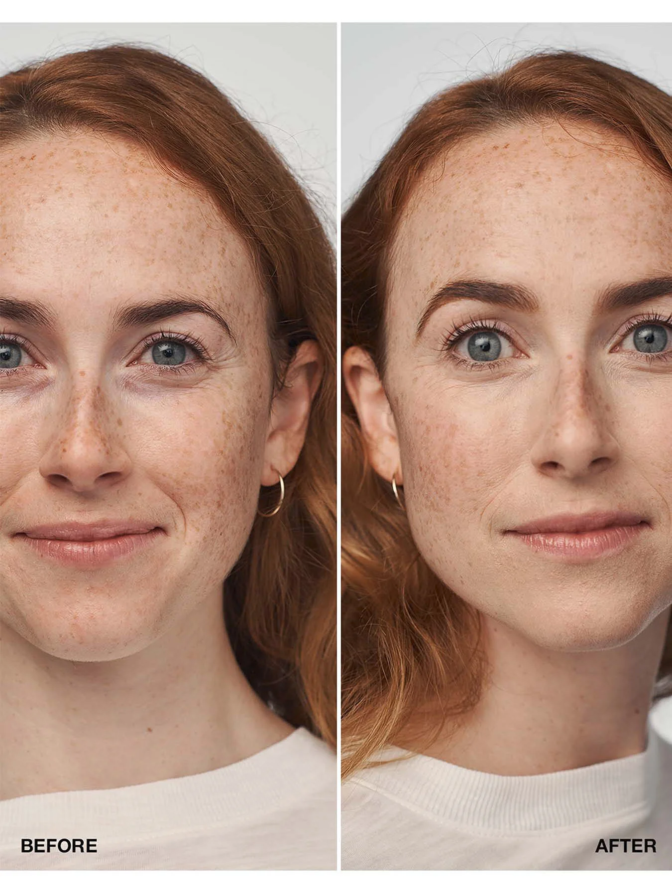 Even Better Clinical™ Serum Foundation SPF20