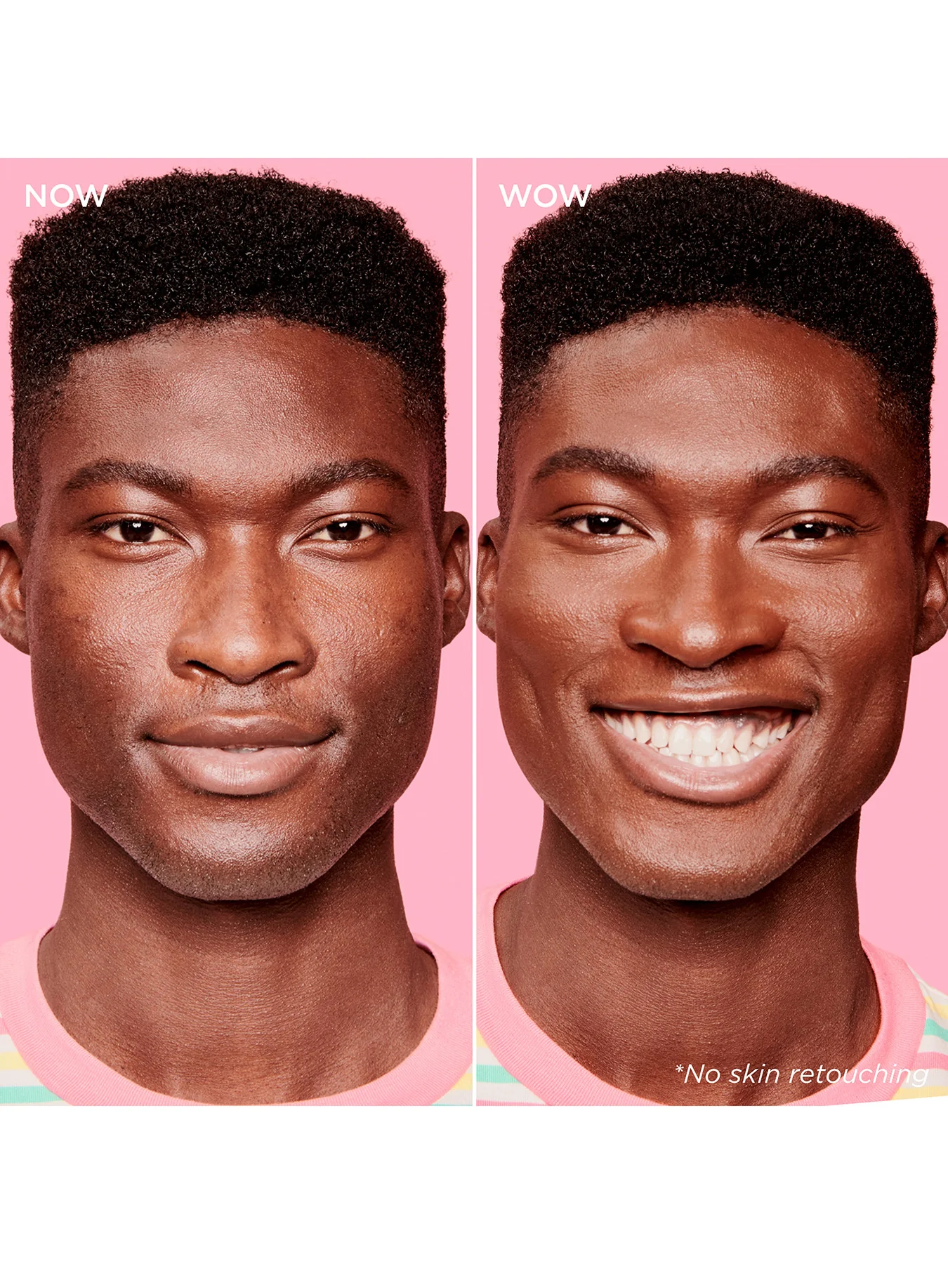 Boi-ing Cakeless Concealer