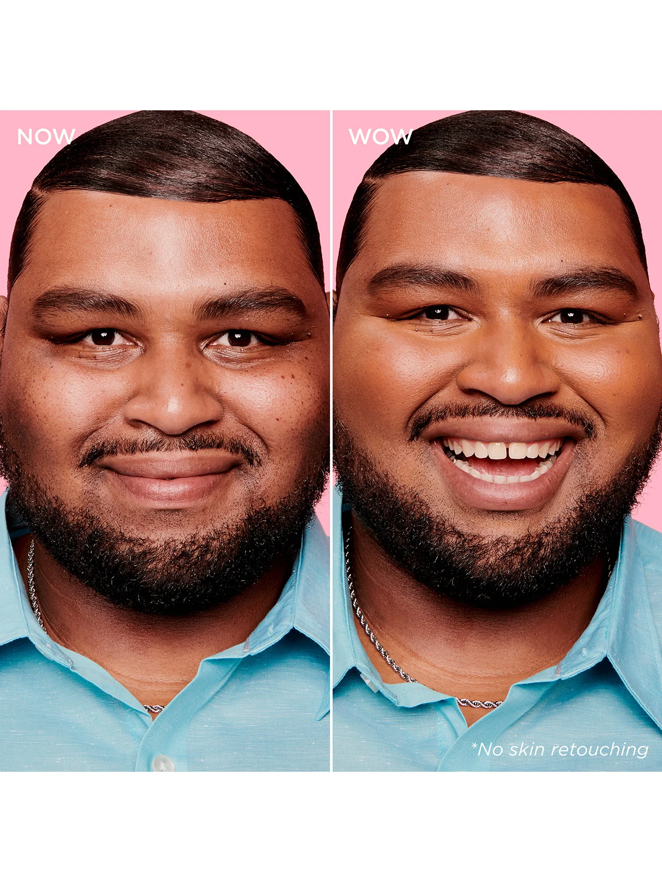 Boi-ing Cakeless Concealer